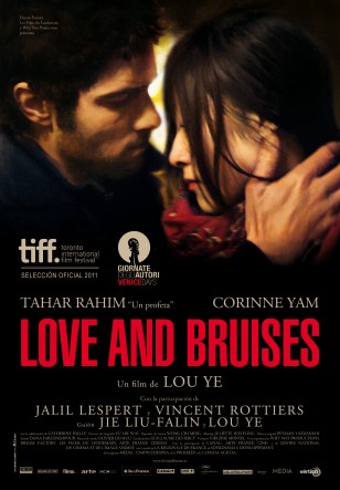 LOVE AND BRUISES
